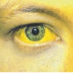 YELLO