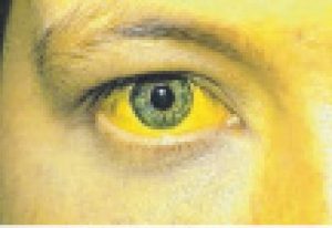YELLO