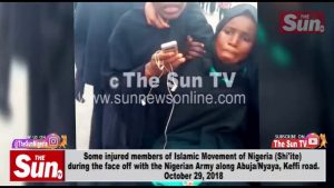 Some injured members of Islamic Movement of Nigeria (Shi’ite) during face off with the Nigerian Army