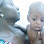 11 month old Jibril Reuben. He is one of the kids suffering from acute malnutrition, at the Federal Medical Centre, Jalingo