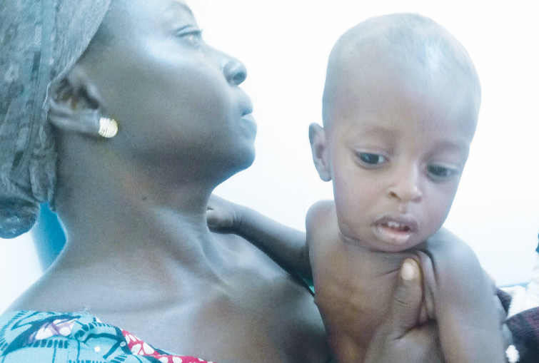 11 month old Jibril Reuben. He is one of the kids suffering from acute malnutrition, at the Federal Medical Centre, Jalingo