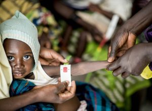 Malnutrition claims 30 lives in Nasarawa