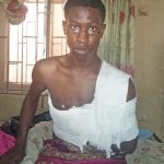 Oluwabamise – revived but with multiple fractures