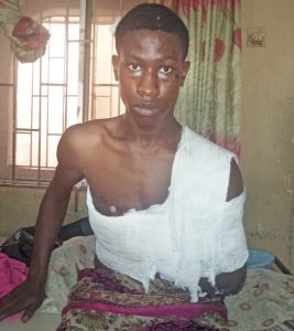 Oluwabamise – revived but with multiple fractures