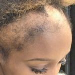 hair