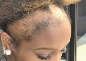 hair