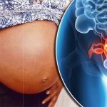 Uterine-fibroids-704091