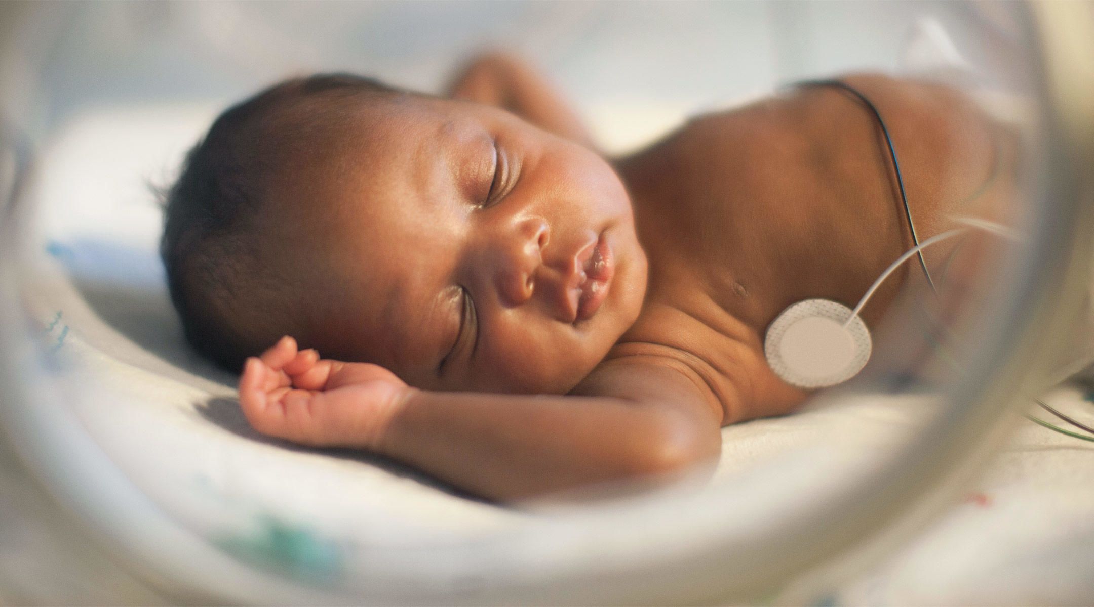 premature baby