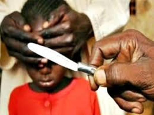 FGM