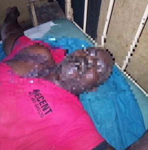 Anambra Man commits suicide after attacking wife with acid