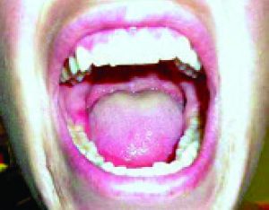 Tooth