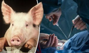 Pig-and-organ-transplant-surgery-839729