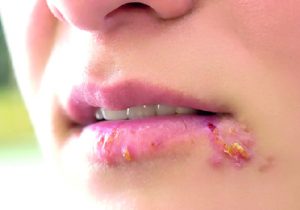 Mouth