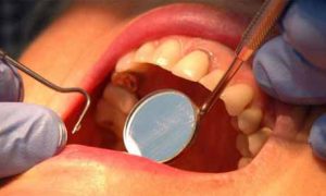 Orthodontic-treatment