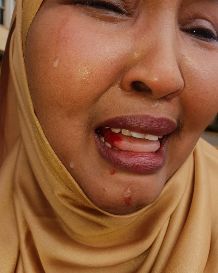 Female-MP-beaten-up-in-Kenya-by-colleague