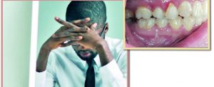 teeth