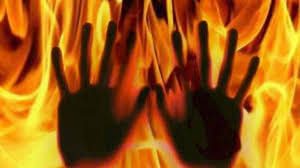 man burn fir