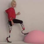 9-year-old double amputee to model at Paris Fashion Week