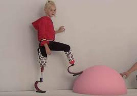 9-year-old double amputee to model at Paris Fashion Week
