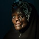 Noma disease silently killing Nigerians