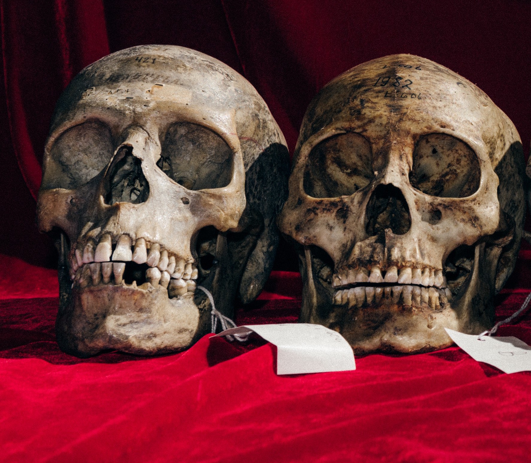 3 men docked for illegal possession of human skulls