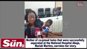 VIDEO: Co-joined Twins Successfully Separated at National Hospital Abuja