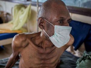Fight coronavirus but don’t forget Tuberculosis – NTS advises gov’t