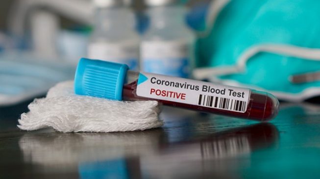 coronavirus3-653×365
