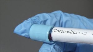 COVID-19 claims another life, as confirmed cases hit 232