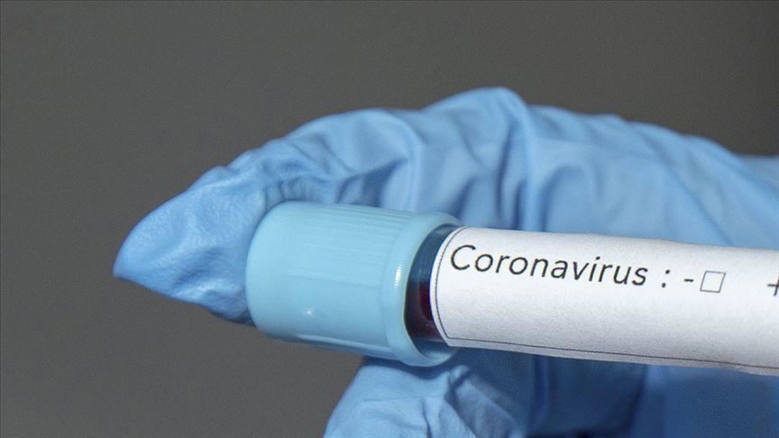 COVID-19 claims another life, as confirmed cases hit 232