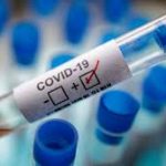 Chairman, 3 members of Kano COVID-19 task force test positive