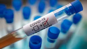Chairman, 3 members of Kano COVID-19 task force test positive