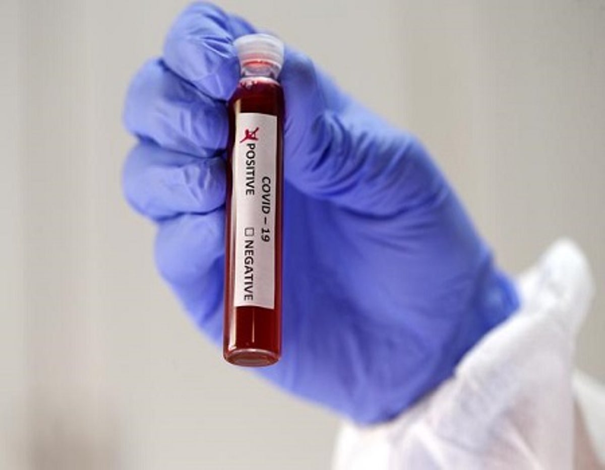 Coronavirus..