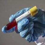 Covid-19- 3 suspected cases in Delta test negative