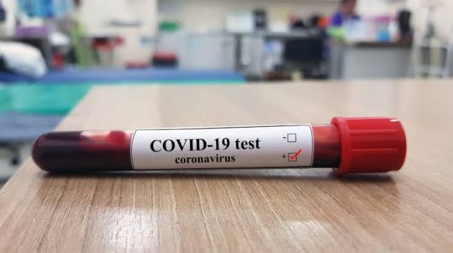 Abia records 5 more COVID-19 cases