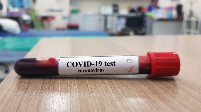 COVID-19-1-653×365