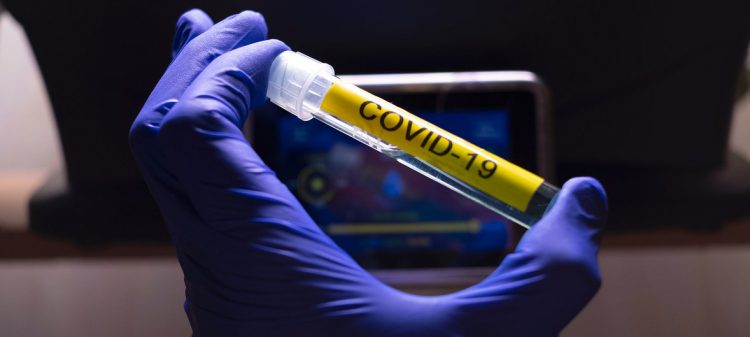 coronavirus-4-750×337