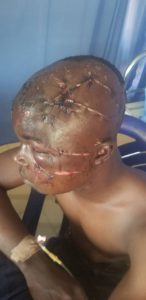 Suspected Fulani herdsmen allegedly attack motorcyclist in Ondo