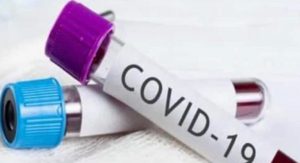 COVID-2-735×400