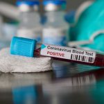 Positive blood test result for the new rapidly spreading Coronavirus, originating in Wuhan, China