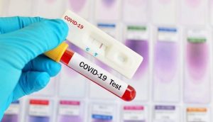 Coronavirus-covid-19-1