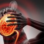 dt_200707_brain_stroke_headache_pain_migraine_800x450