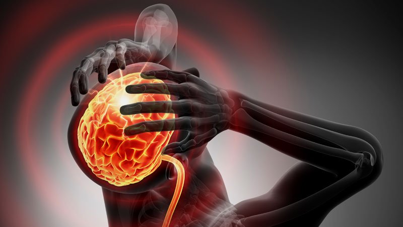 dt_200707_brain_stroke_headache_pain_migraine_800x450