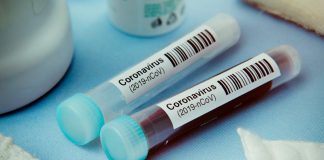 is_200225_coronavirus_covid-19_test_800x450-324×160