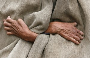 Kogi records 20 new cases of leprosy