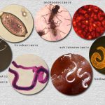 FG reiterates commitment to curbing neglected tropical diseases
