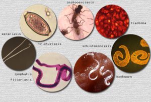 FG reiterates commitment to curbing neglected tropical diseases