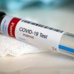 COVID-19-positive