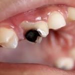 teeth