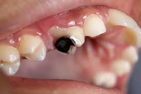 teeth